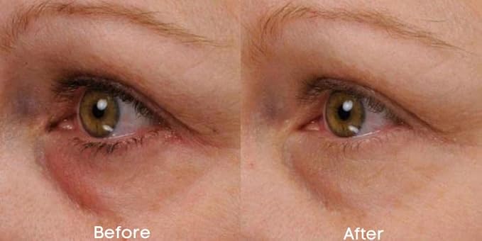 Renew & Firm Eye Serum