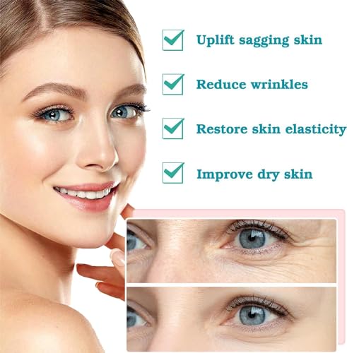 PCL Threads for Face Mono Screw Type 30G38MM PCL Threads for Face & Body Lift Smoothing of Wrinkles with Sharp Tips 20pcs Long Lasting Tighten Skin and Firming