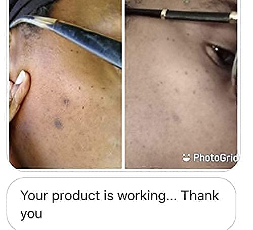 Vitamin C+ Serum Lightens Dark Spots, Repairs Damaged Skin and Helps to Prevent Signs of Aging.