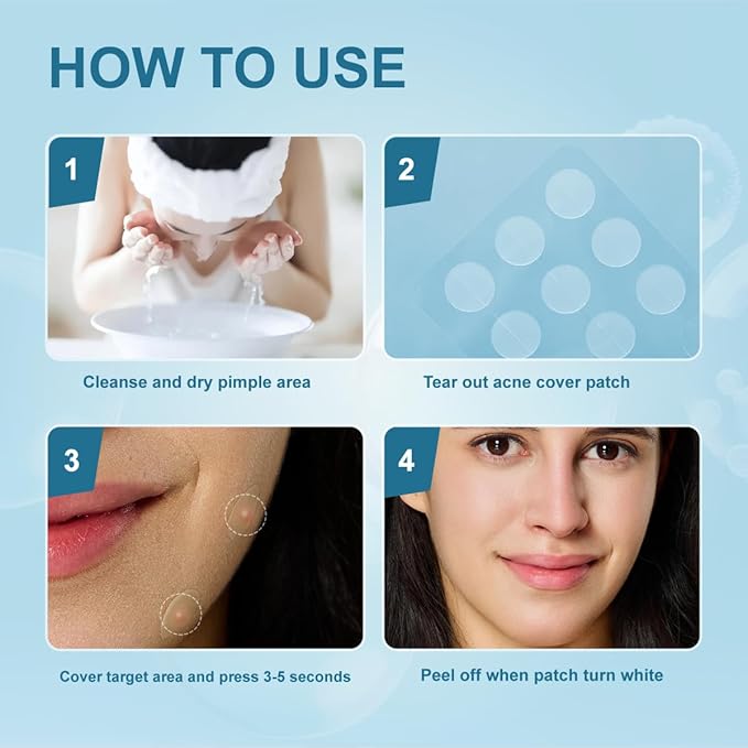 Pimple Patches for Face, Hydrocolloid Acne Patches, Absorb Zits and Blemishes, Invisible Spot Cover, Treatment for Breakouts, Acne Stickers with Salicylic Acid and Tea Tree Oil (24 Count)