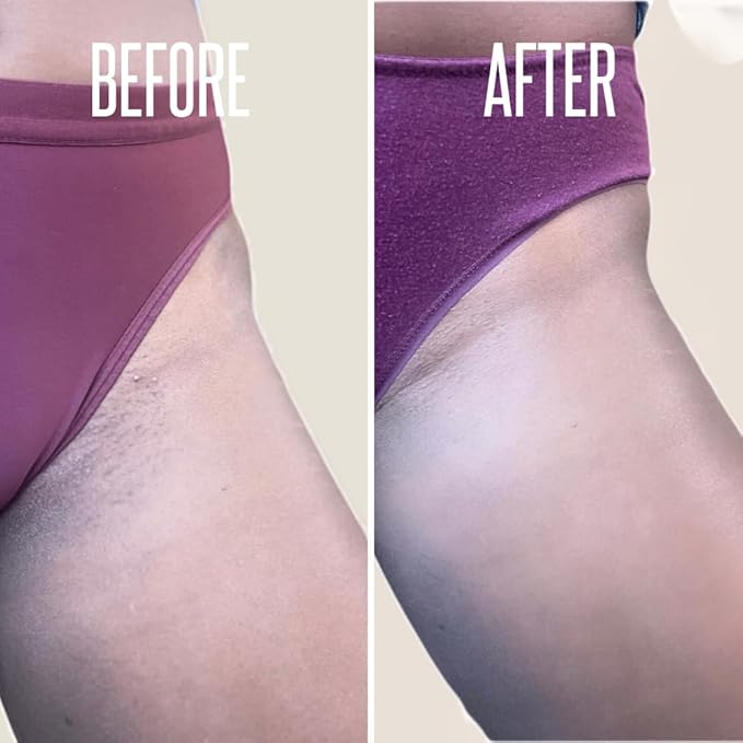 Save 14% on The Skin Care Solution For Dark Spots, Razor Bumps, Ingrown Hair & Razor Burns ā Includes Our Ultra Potent Brightening + Razor Bumps Solution For an Ultra Clear & Glowing Skin