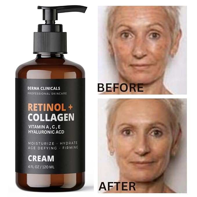 Retinol + Collagen, Hyaluronic Acid, Vitamin C Anti-Aging Face Cream, Day and Night Moisturizing Cream, Anti-Wrinkle Cream for Face, Firming Cream - 4oz