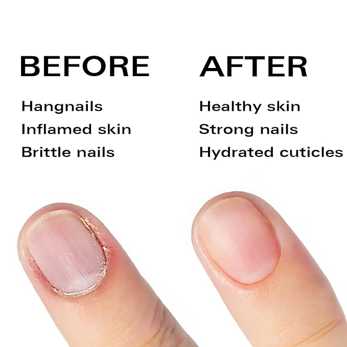 Nail Oil Cuticle Pen - Peach - Nail Strengthener & Growth Serum with Vitamin A, D, E, B5, Grapeseed & Natural Oils - Repair for Brittle, Peeling, Thin Nails - Twist Brush Pen