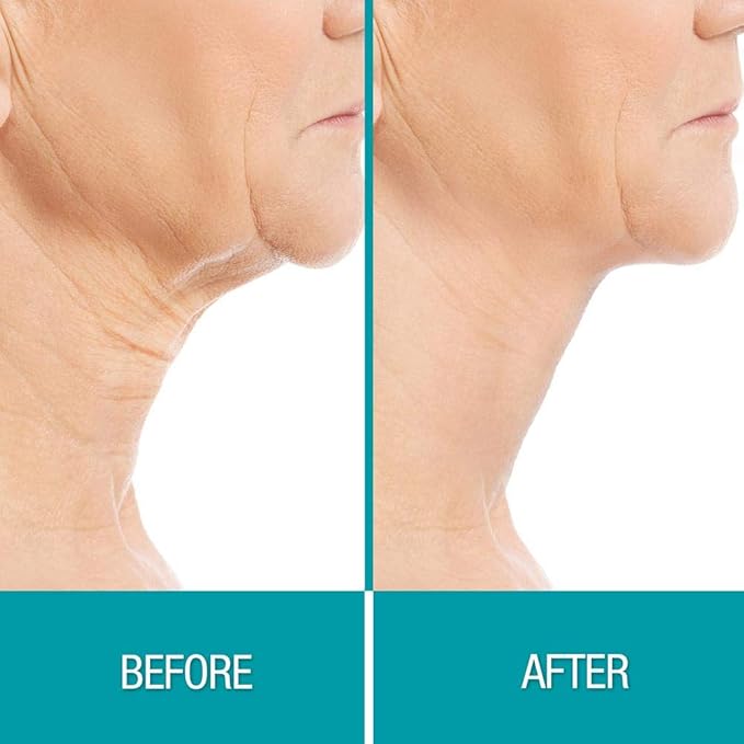 Collections Etc Dermactin-TS Crepe Be Gone Skin Firming Collagen Chin Mask .35 ounce Packette