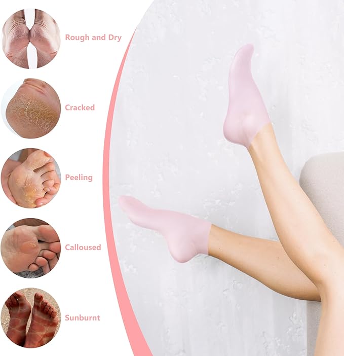 2Pairs Silicone Socks for Dry Cracked Feet Women,Non-Slip Moisturizing Foot Mask Exfoliating Socks,Cracked Heel Treatment and Silicone Moisturizing Foot Socks for Women - Pink + White