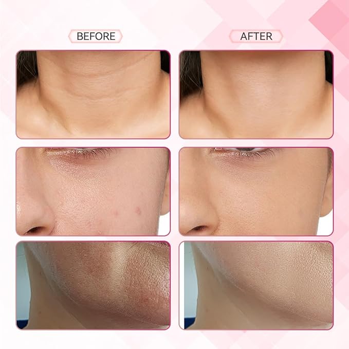 Face Neck Massager, 7-in-1 Face Sculpting Tool, Facial Massager for Skin Care, Face Massager with Vibration(White)