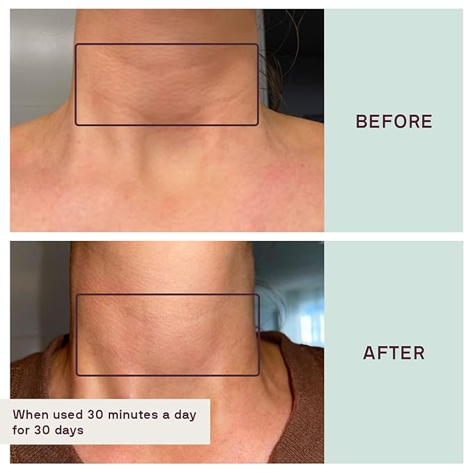 Dermaclara Neck Wrinkle Patches - Silicone Neck Patches for Wrinkles, Anti Aging and Tightening Overnight Skin Treatment for Women and Men, Anti-Wrinkle Pads, Reusable Up to 30 Times - 1 Patch
