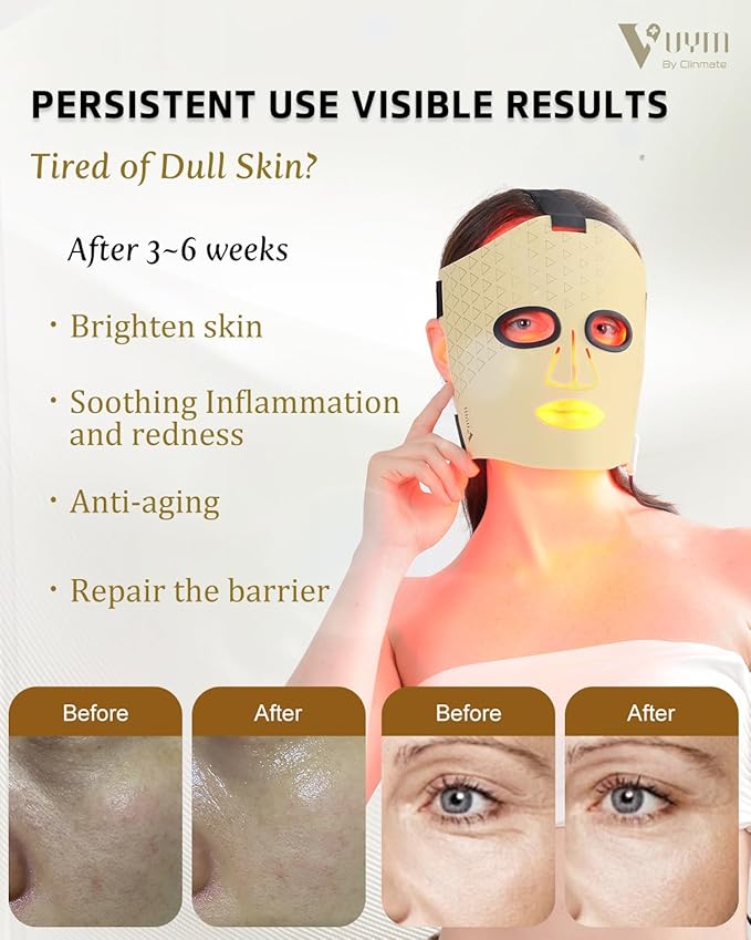 VYM LED Face Mask Light Therapy: Portable Remote High-Energy Anti-Aging Skincare Device, 292 LEDs Professional Infrared Red Light Therapy for Face, Red Light Mask Gift Pack - Gold