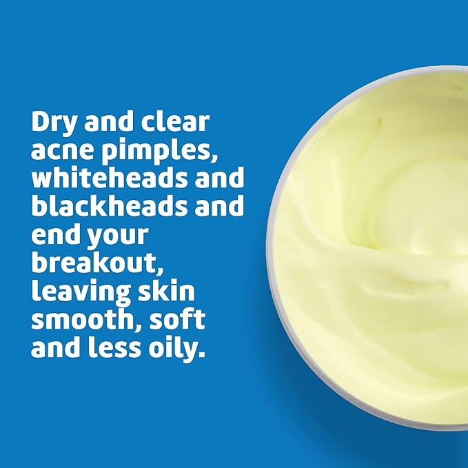 De La Cruz 5% Sulfur Ointment Travel Size - Cystic Acne Treatment for Face and Body - Daily 10 Min Spot Treatment and Effective Game Changing Hormonal Acne Treatment that Clears Up Pimples 0.21OZ