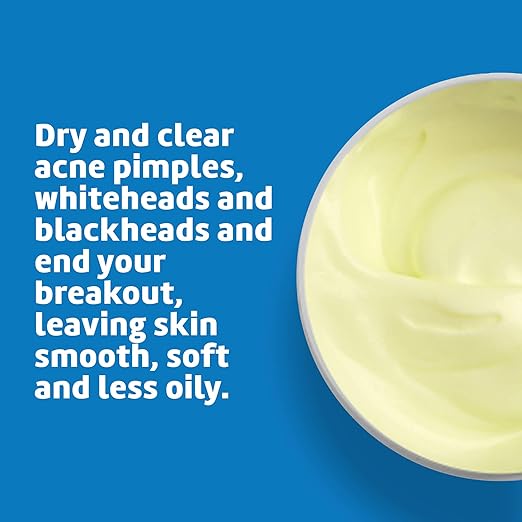 De La Cruz 10% Sulfur Ointment - Cystic Acne Treatment for Face and Body - Daily 10 Min Spot Treatment Mask - Safe and Effective Game Changing Hormonal Acne Treatment That Clears Up Pimples - 2.6 oz
