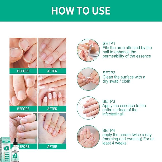 Kerassentials Toenail Oil, Kerassentials Nails Nutrient Oil, Nail Repair Solution 30ML/1PCS (4PCS)