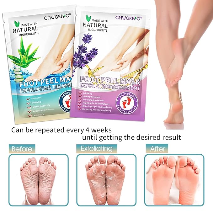 5 Pack Foot Peeling Mask,Exfoliator Peel Off Calluses Dead Skin Callus Remover,Foot Mask for Dry Cracked Feet,Foot Peel Mask for Men and Women Feet Peeling Mask for Mothers Day Gifts