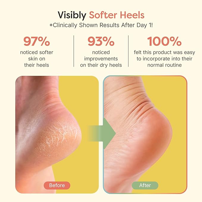 ZenToes Moisturizing Socks for Cracked Heel Treatment - Vitamin E, Olive Oil and Jojoba Oil Infused Heel Socks to Soften and Hydrate (Fuzzy Lilac Purple, Regular)