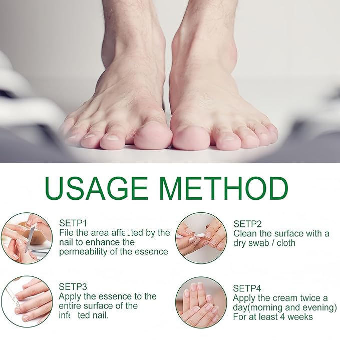 2Pcs Ginger Nail Strengthener for Damaged Nails, Hand and Foot Nail Growth Serum Kit, Ginger Nail Serum for Cracked Nails, Hand & Foot Strengthener Set, Fingernail Repair for Split, 30ML Each