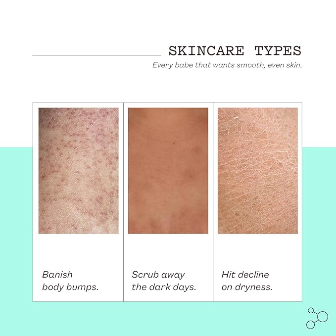 frank Body Glycolic Body Scrub | Vegan, Cruelty Free, Exfoliating Body Scrub | Helps to Fight Breakouts and Soothes Skin & Marks with AHA, Pumice, Witch Hazel, and Niacinamide | 8.82 oz / 250 g