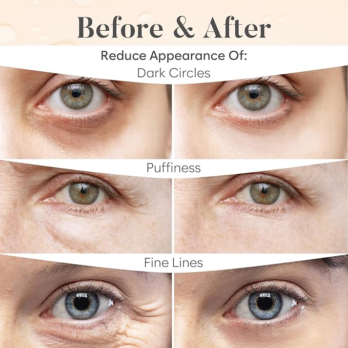 Caffeine Under Eye Patches(30 Pairs) Under Eye Patches for Dark Circles, Puffy Eyes - Caffeine
