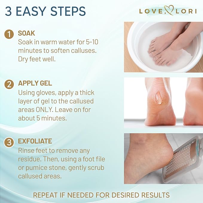 Professional Foot Scrubber Dead Skin Remover Kit - Foot File & Callus Gel Feet Scrubber Scraper Bundle, 6oz