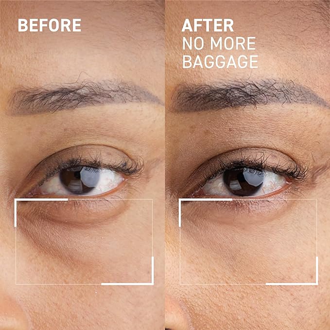 Dr. Brandt Needles No More, No More Baggage - Minimizes Under-Eye Bags, Puffiness & Dark Circles - 0.5 oz