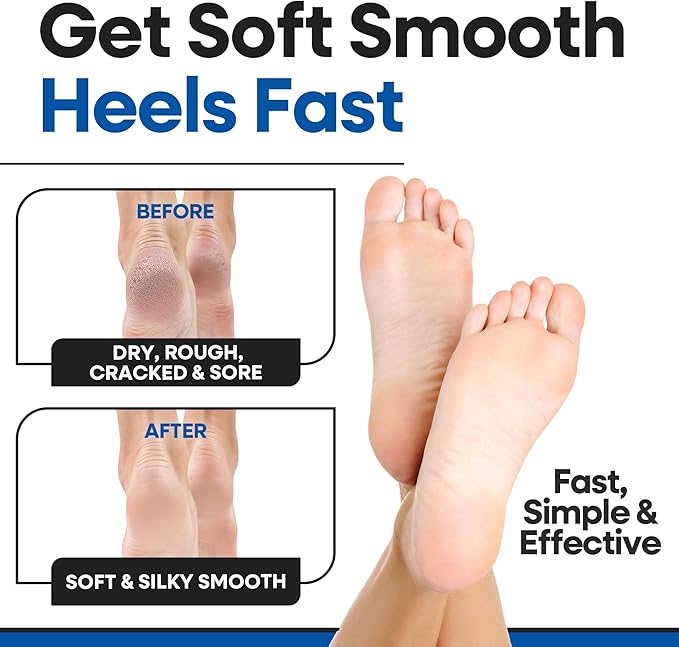 Moisturizing Socks for Women & Men | Aloe Vera Cracked Heel Treatment | Foot Callus Remover | Aloe Socks for Cracked Heels & Dry Feet | Lotion Infused Gel Heel Sleeves (Fits Most)
