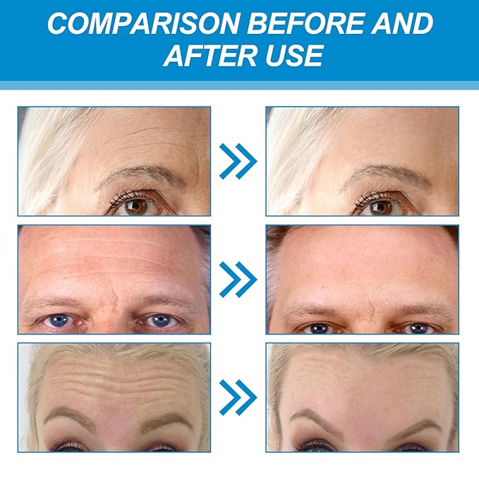 Forehead Wrinkle Patches 10Pcs with Aloe, Collagen, Vitamin E, Anti Wrinkle Patches, Forehead Wrinkles Treatment, Face Tape for Wrinkles Care to Smooth Fine Lines & Wrinkles for Women