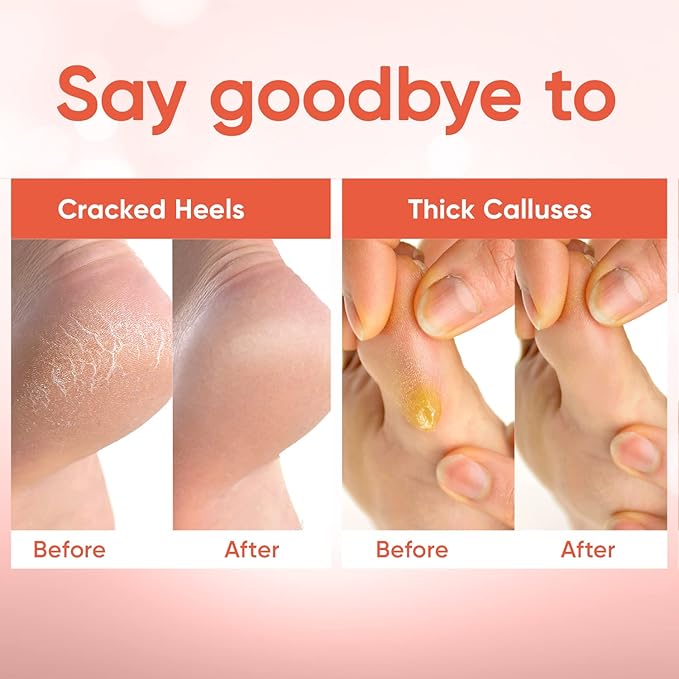 Foot Peel Mask - Foot Mask for Baby Soft Skin - Remove Dead Skin, Dry, Cracked Feet & Callus, Foot Spa, Made with Aloe Vera Extract for Women and Men (3 Pairs Peach)
