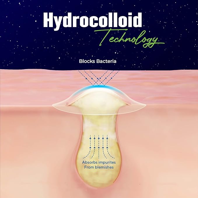 Dot Pimple Patches for Face β Hydrocolloid Acne Patches for Quick Zit Relief And Blemishes, Invisible Spot Stickers That Stay All Night, Gentle for All Skin Types, Oil-Free (80 Count)