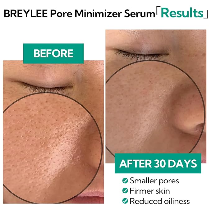 Pore Minimizer Serum, BREYLEE Pore Refining Serum for Face & Nose, Oil Control Firming, Shrinking Pore & Tightening Skin, Pore Moisture after Blackhead Remover, Clam and Soothing Skin Care