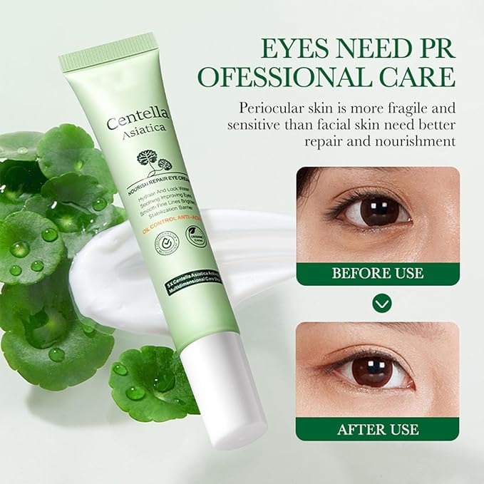Centella Asiatica Eye Cream,Moisturizes and Tightens the Skin Around the Eyes,Reduces Dry Lines and Fine Lines,Improves Dark Circles Under the Eyes,Lightweight Refreshing,Non Greasy