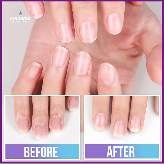 Teenitor Nail Files and Buffers, Cuticle Remover, Nail Care Kit, Nail File, Cuticle Softener, Cuticle Oil, Cuticle Pusher, Cuticle Peeler Scraper, Cuticle Remover Liquid, Nail File Kit Lavender