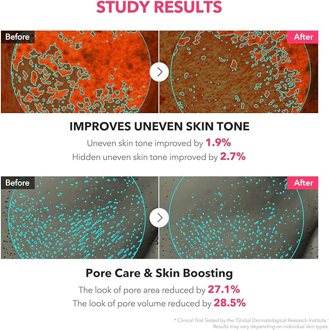 APRILSKIN TXA Niacinamide Toning Shot 99 Spicule Facial Serum|Skin Booster Serum|99% High-Purity Tranexamic Acid 3% + Niacinamide 5% for Uneven Skin Tone, Pore Care|Korean Skin Care|1.01 fl. oz.