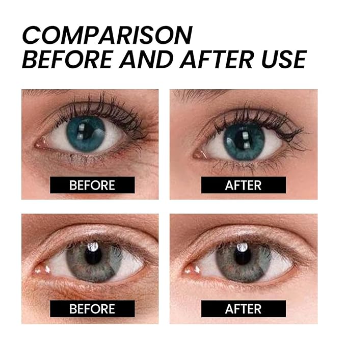 Naturals Instant Eye & Face Lift Cream Rapid Under Eye Bags Wrinkles Puffiness Remover for Women and Men in 60s -Temporary Firming & Tightening Treatment - Wrinkle Filler 30ml*2pcs