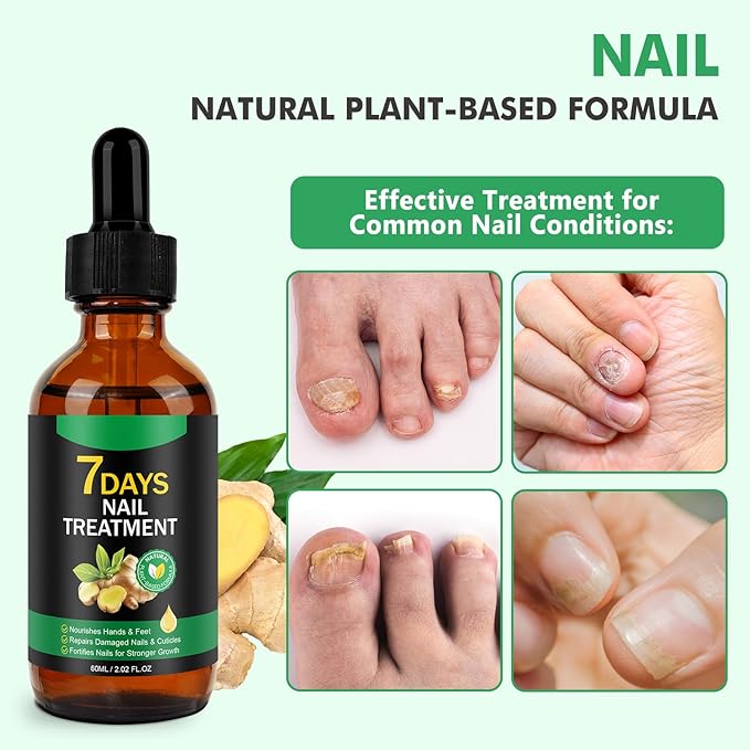 Ginger Nail Serum,Nail Growth Serum, Ginger Cuticle Care Oil for Strengthen Nails & Promote Nail Growth, Natural Plant Formula 2 Fl.oz
