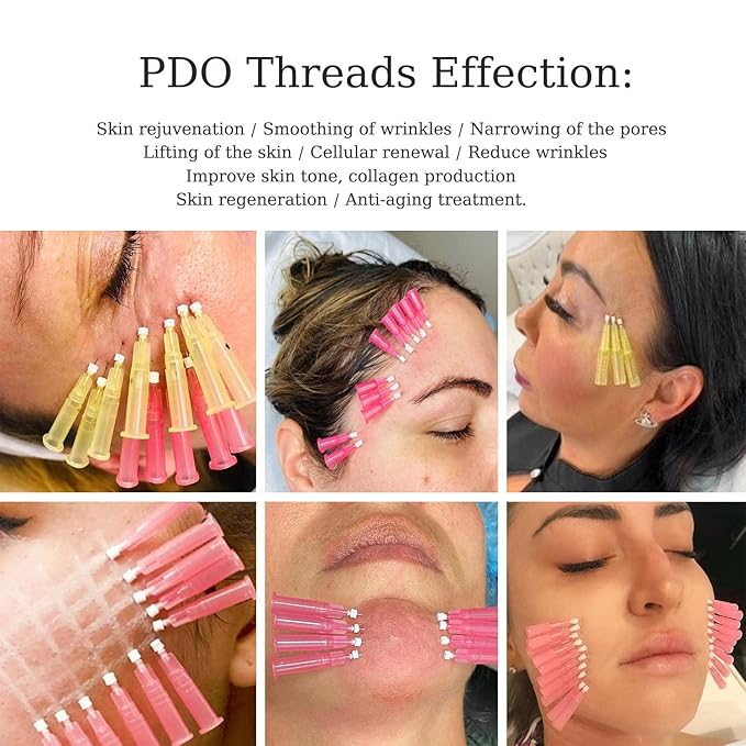 elves Pdo Threads for Face Lift & Whole Body Lifting, Pdo Mono Threads 29G25mm 20Pcs