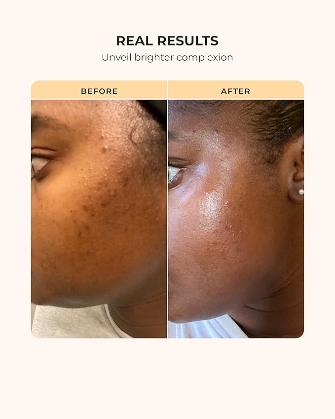 Buttah Skin Supreme Kit for Melanin Rich Skin | Oil-Free Hyaluronic Gel Cream 2 oz | Vitamin C Serum 1 oz | Cleanser 3.4 oz | Rosewater Toner 3.4 oz | Black Owned Skincare