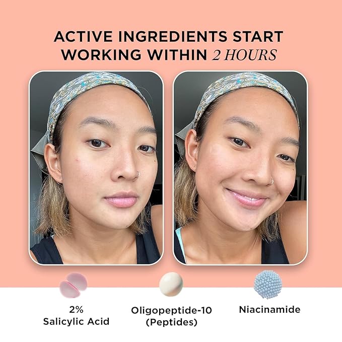 ZitSticka Extra Strength Killa Acne Patches for Face - World's Most Potent Pimple Patch with Fast-Acting Microdarts - Starts Working within 2 Hours for Deep, Early-Stage Zits & Blemish - 20 Count