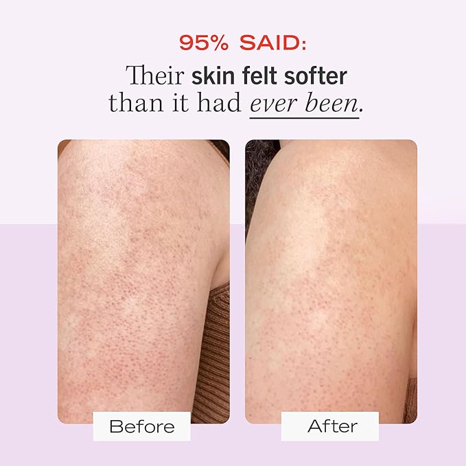 First Aid Beauty - KP Bump Eraser Body Scrub with 10% AHA, Keratosis Pilaris Skin Exfoliater with Glycolic and Lactic acids, Helps Reduce Chicken Skin Bumps, Safe for Sensitive Skin, 8 oz + Bonus, 2ct