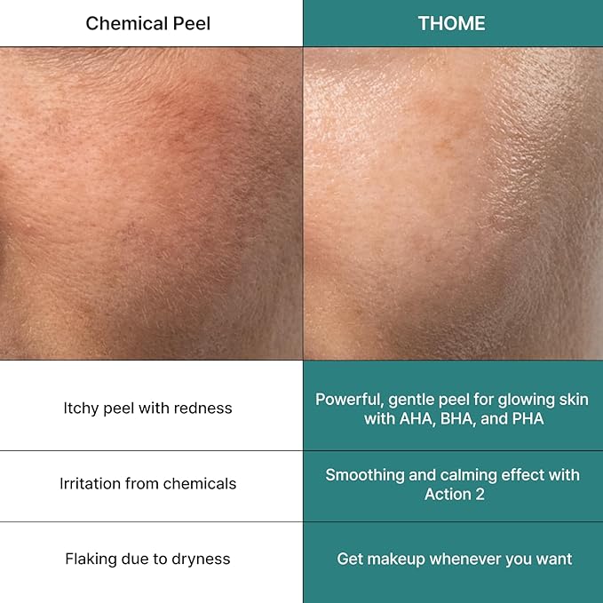 THOME G-Peel Program (6 Sheets) | 4-Step Gentle Peeling for All Skin Types, Sensitive & Dry Skin | Perfect Routine to address fine wrinkles, lines, and hyperpigmentation