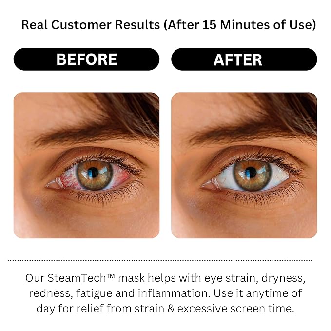 Self Heating Eye Mask - Steam Eye Mask for Dry Eyes, Soothing Relief, Stress Reduction - Disposable Warm Eye Compress Moist Heat
