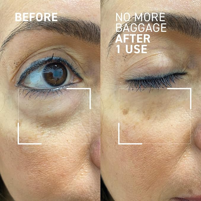 Dr. Brandt Needles No More, No More Baggage - Minimizes Under-Eye Bags, Puffiness & Dark Circles - 0.5 oz