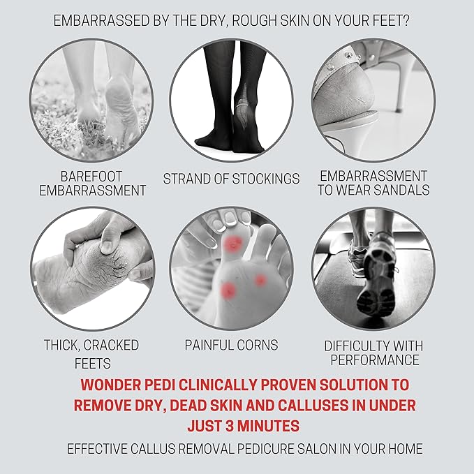 Made in Germany Double-Sided Metal and Emery Foot File - Heel Scraper & Cracked Feet Repair Instant Exfoliating Peel Foot Spray - Dead Skin Remover Cracked Heels Softener. Wonder Pedi
