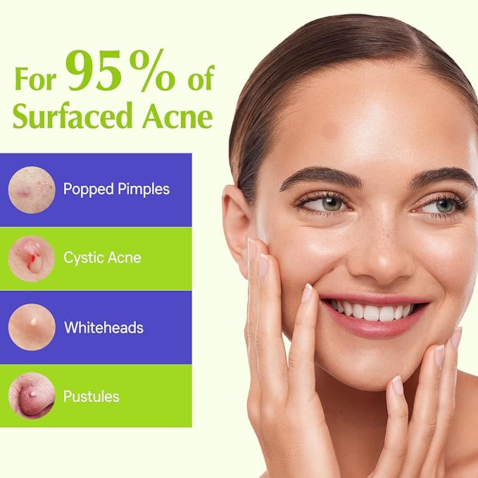 Pimple Patches For Face, Invisible Hydrocolloid Acne Patches Acne Treatment,Covering Zits & Blemishes in Skin and Face, Zit Patches with Salicylic Acid, FSA HSA Store Eligible Items 48 Count