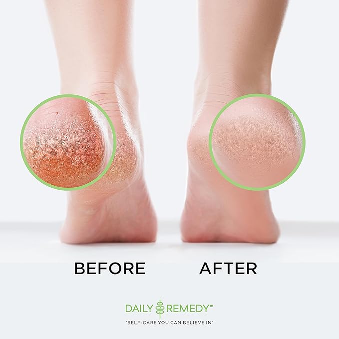 DAILY REMEDY EXTRA STRENGTH Tea Tree Oil Foot Soak w/ Epsom Salt Made in USA Toenails,Athlete's Foot,Itchy Feet,Stubborn Smelly Foot Odor,Pedicure Calluses & Soothes Sore Tired Achy Feet 16 oz,Black