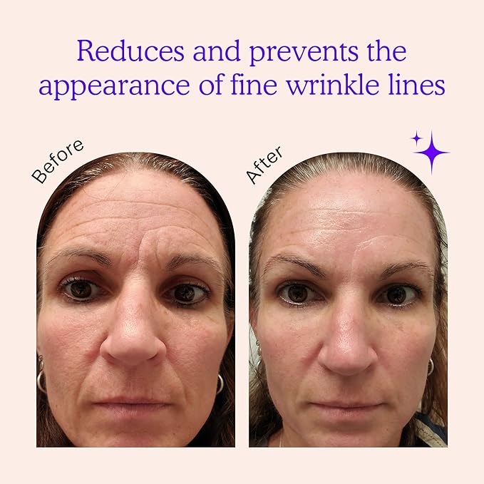 BLUMBODY Face & Forehead Wrinkle Patches - Anti Wrinkle Facial Patches to Smooth Eye, Mouth, Forehead Wrinkles - Non-Silicone Face Tape for Fine Wrinkles between Eyes & Face - Patches (30 day supply)