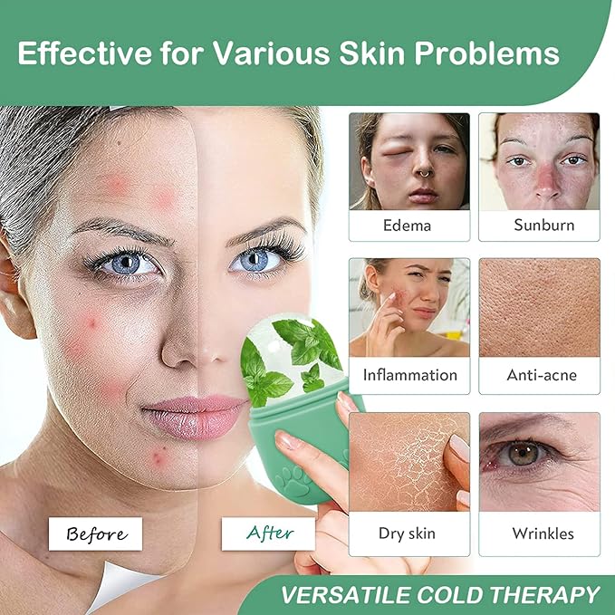 Face Ice Roller, Ice Cube Roller for Eye Puffiness Relief, Silicone Icer Tool for Face and Neck to Relieve Fine Lines Puffiness Pores Wrinkles (Green)