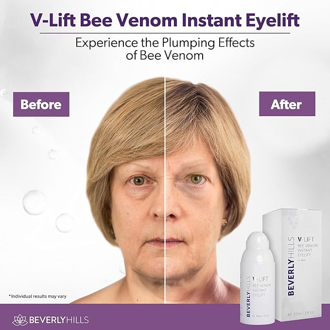 Beverly Hills V-lift Instant Eye Lift & Mens Instant Facelift Bundle with Discount - Eye Serum Treatment for Dark Circles, Wrinkles & Under Eye Bags for Women & Men, 30mL (120 Days Supply Each)