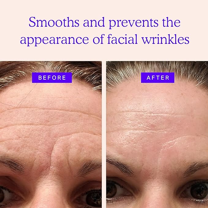 BLUMBODY Face & Forehead Wrinkle Patches – Mini Anti-Wrinkle Facial Patches for Eyes, Mouth & Forehead – Triangle Non-Silicone Face Tape for Elevens, Crows Feet and Fine Lines – 160 Facial Patches