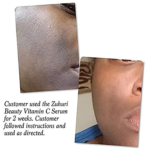 Vitamin C+ Serum Lightens Dark Spots, Repairs Damaged Skin and Helps to Prevent Signs of Aging.