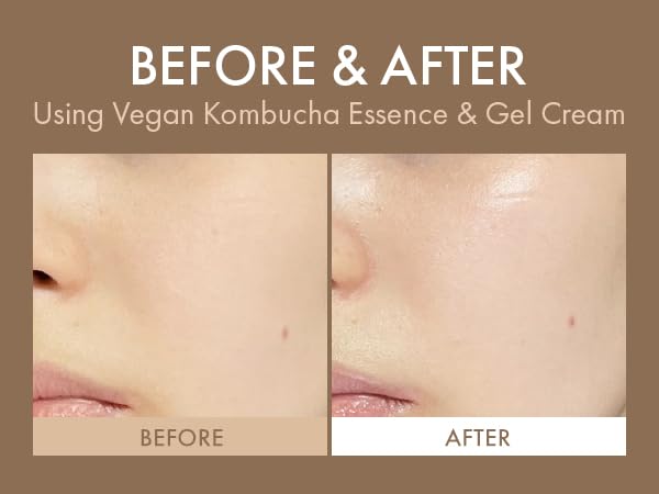 Dr.Ceuracle Vegan Kombucha Tea Gel Cream - Korean Skincare Lightweight Watery Hydrating Moisturizer with Kombucha Tea Extract, Sunflower Seed Oil (75g / 2.64 oz.)