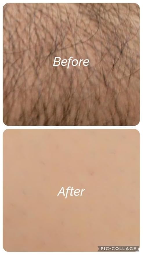 ARABESKS Dermaplaning Tool, 3ct | Dermaplane, Face Razors for Women, Eyebrow Razor, Facial Razor, Dermaplaning Razor, Womens Face Razor Peach Fuzz Remover, Eyebrow Trimmer