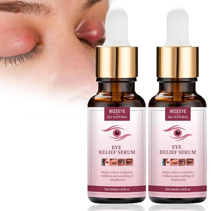 Chalazion Eye Treatment For Blepharitis, 2 PCS Moisturize Eyelids Serum and Chalazion Remover, Gentle Under Eye Relief Serum For Dark Circles, Eye Bags, Puffiness.
